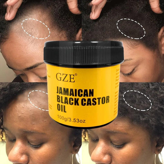 GZE JAMAICAN Black Castor Oil Pure Cold-Pressed for Hair Growth, Skin Moisturizing and Scalp Health - Promoting Thick Hair - Soluna Bliss